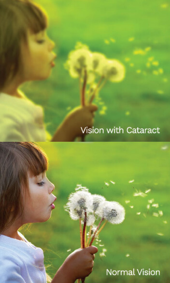 vision-img